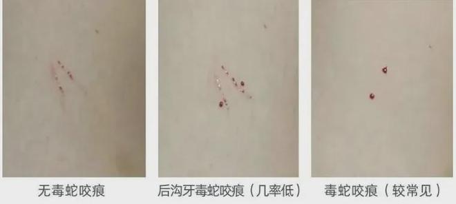 公园再次惊现！紧急提醒：深圳近期接诊9例！网友吓坏